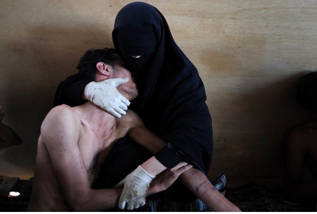 Một phụ nữ che kín mặt đang ôm một thân nhân bị thương trong một cuộc xung đột tại Yemen. Ảnh Samuel Aranda của tờ The New York Times giành giải thưởng ảnh báo chí năm 2011.