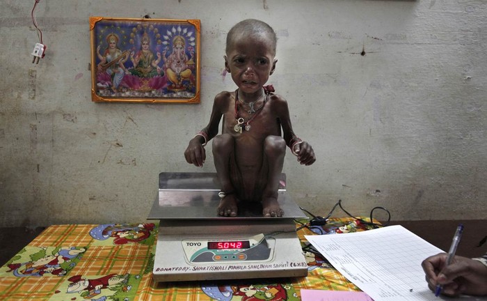 Bé Rajni (2 tuổi) bị suy dinh dưỡng đang được các nhân viên y tế cân kiểm tra sức khỏe tại Trung tâm phục hồi chức năng cho trẻ suy dinh dưỡng của huyện Shivpuri, bang Madhya Pradesh, miền đông Ấn Độ hôm 1/2.