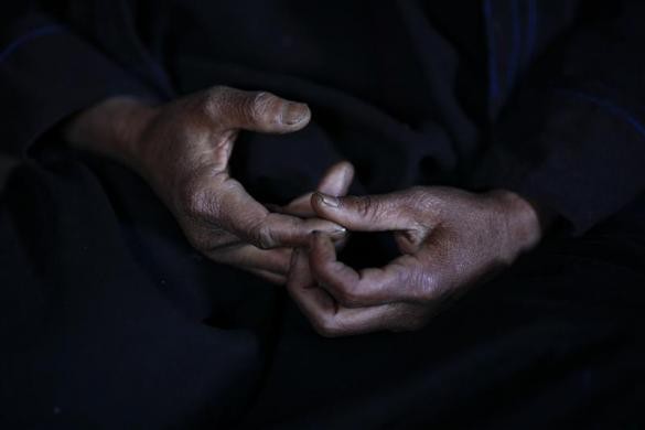Bàn tay của Moe Mohm, 48 tuổi, một góa phụ người Pa-O đã tình nguyện phá hủy ruộng trồng thuốc phiện của gia đình mình tại làng Kyauk Ka Char ngày 29/1/2012.