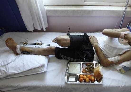 Khay thức ăn được đặt cạnh người đàn ông Syria bị thương trên giường bệnh ở thành phố Antakya, Hatay ngày 9/6/2011.
