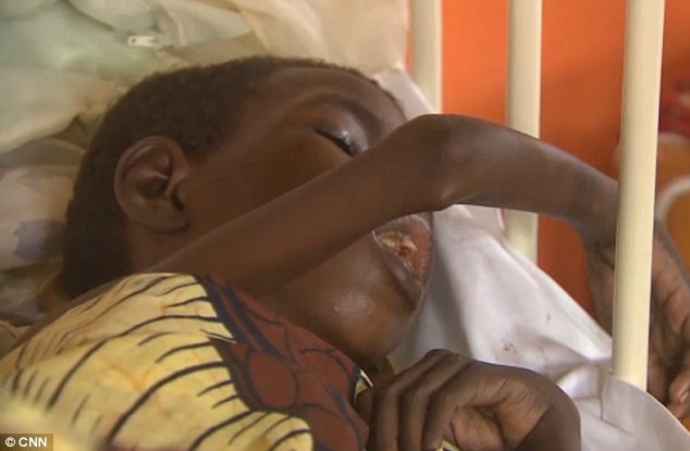 Riêng miền bắc Uganda đã có 3.000 trẻ mắc phải căn bệnh lạ lùng này