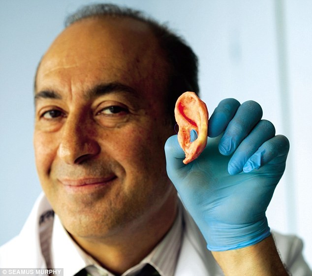 Giáo sư Alexander Seifalian với một chiếc tai được phát triển trong phòng thí nghiệm