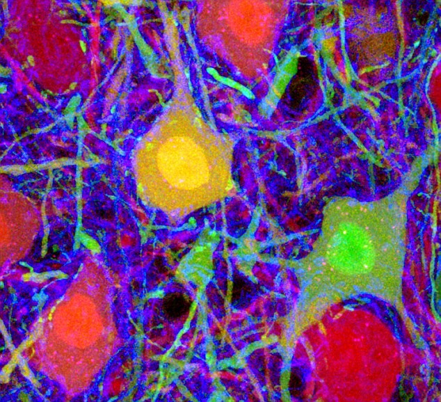 Tế bào thần kinh trong não người