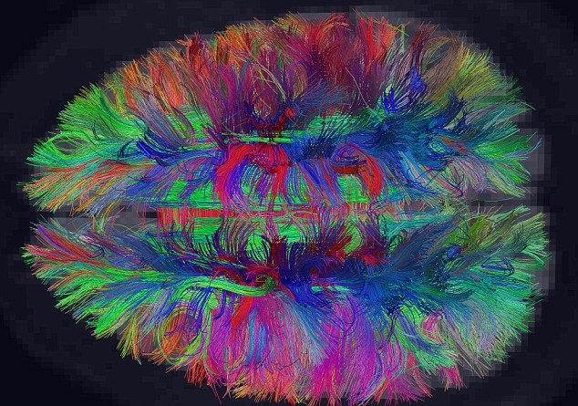 Bản đồ cho thấy sự kết nối của các tế bào thần kinh trong não người
