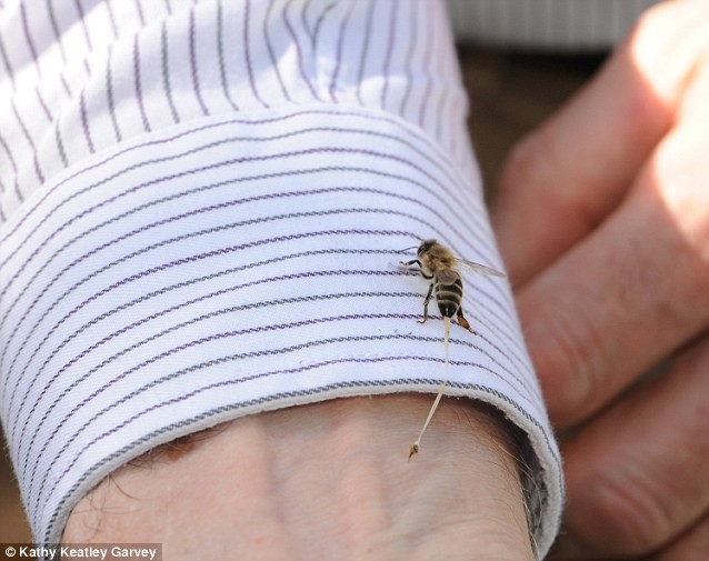 Con ong mật để lại ngòi và mô bụng sau khi đốt một người đàn ông.