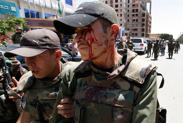 Một binh lính quân đội Syria bị thương sau khi một quả bom phát nổ ngay kề xe tải quân sự của mình tại thành phố Daraa, Syria, ngày 9 tháng 5 năm 2012.