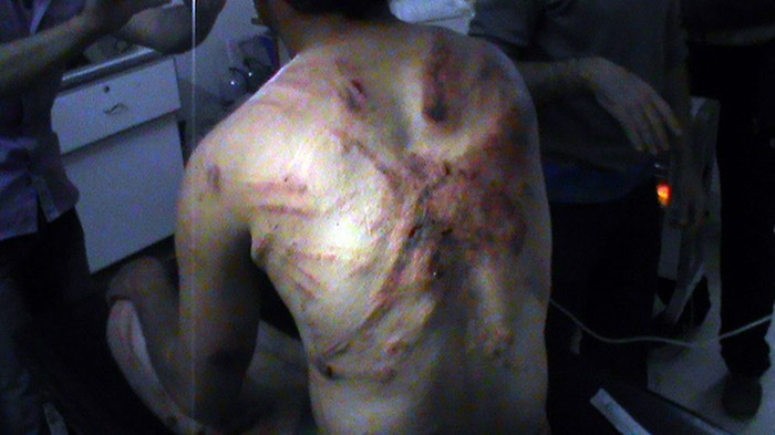 Một người đàn ông Syria cho xem các vết thương tại thành phố Rastan, tỉnh Homs ngày 27/4/2012.