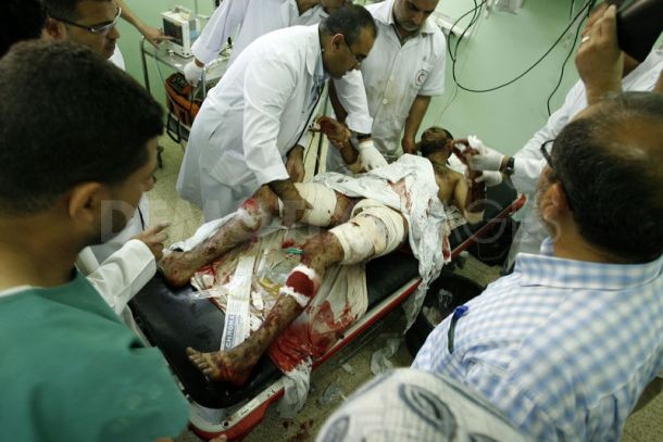Một người đàn ông Palestine bị thương nặng trong cuộc không kích của quân đội Israel tại Khan Younis, nam Dải Gaza.