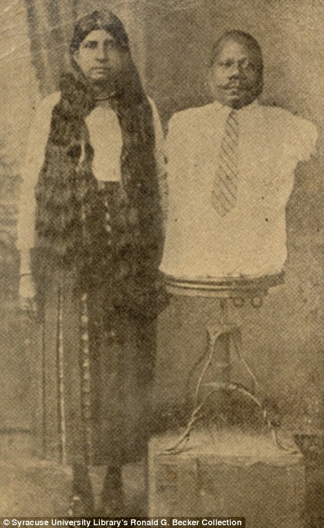 Prince Randian (phải) khi sinh ra đã không có chân tay nhưng có thể cạo râu, vẽ, viết và thậm chí là cuộn được thuốc lá.
