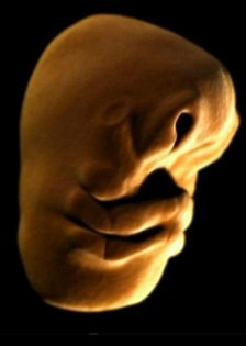 Bào thai bắt đầu hình thành các rãnh và vách ngăn tạo ra khuôn mặt cho em bé.