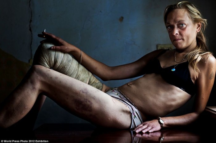 Gái mại dâm Maria nghỉ ngơi tại căn phòng đi thuê ở Kryvyi Rih, Ukraine, đất nước có tỷ lệ HIV/AIDS cao nhất châu Âu - theo UNICEF. Ảnh của nhiếp ảnh gia người Nam Phi Brent Stirton.