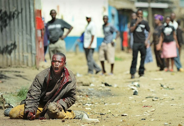 Một người đàn ông bị chảy máu sau khi bị tấn công bằng dao phay bởi những người Somalia trong cuộc đụng độ sắc tộc ở vùng ngoại ô Eastleigh của thủ đô Nairobi hôm 19/11.