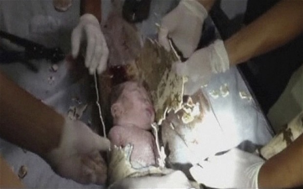 Lính cứu hỏa phá vỡ đoạn đường ống giải cứu em bé 2 ngày tuổi đã sống sót một cách kỳ diệu.