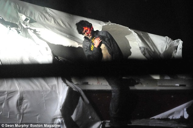 Tsarnaev để lộ thân hình có những vết bầm tím.