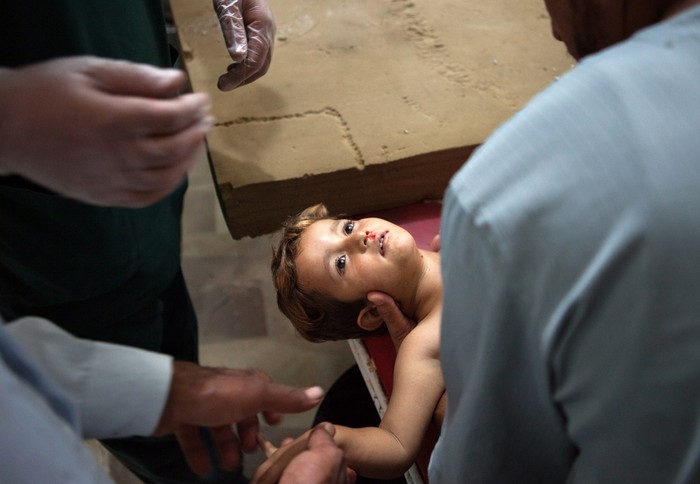 Bác sĩ điều trị cho một bé gái Syria bị trúng mảnh đạn sau một cuộc không kích ở thị trấn phía bắc của Syria, Saraqeb, thuộc tỉnh Idlib ngày 19/7.