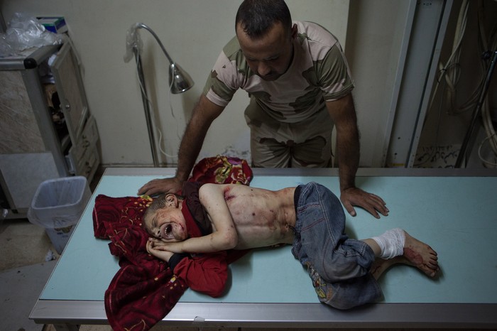 Ahmad Jabir (7 tuổi) bị thương trong một trận pháo kích khóc trên bàn chụp X-quang tại bệnh viện ở tỉnh Idlib ngày 10/7.