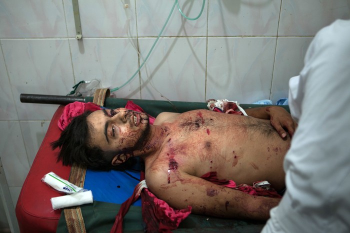 Một người đàn ông Syria bị thương được điều trị y tế tại một bệnh viện ở thị trấn Ariha, trên địa bàn tỉnh Tây Bắc Idlib, ngày 21 tháng 7.