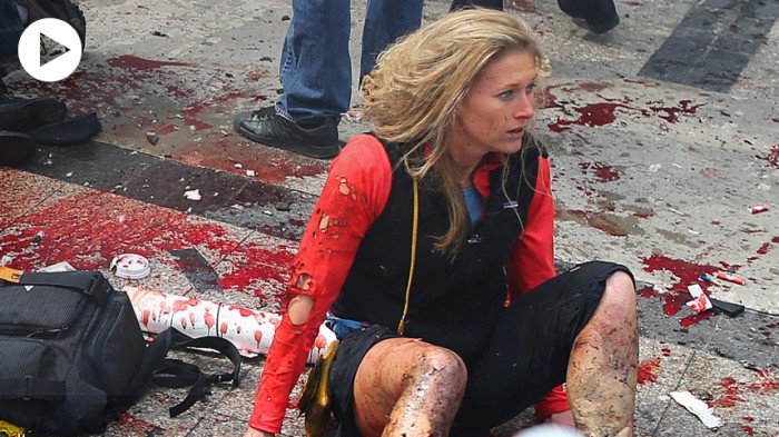 Một phụ nữ bị thương trên nền đường đẫm máu sau vụ đánh bom tại Boston.
