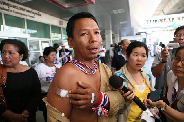 Một người biểu tình bị thương trong vụ tấn công.
