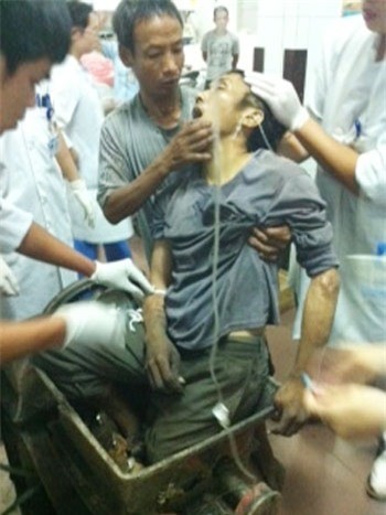 Anh N được đưa đến viện trong tình trạng hai chân vẫn bị kẹt trong máy nghiền đất, lả đi vì đau đớn và sốc đa chấn thương. Ảnh: BS cung cấp.
