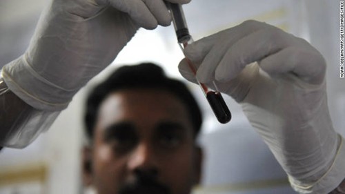 Các nhà khoa học tại Viện Pasteur, Paris có thể kiểm soát sự phát triển của virus HIV trên một số bệnh nhân.