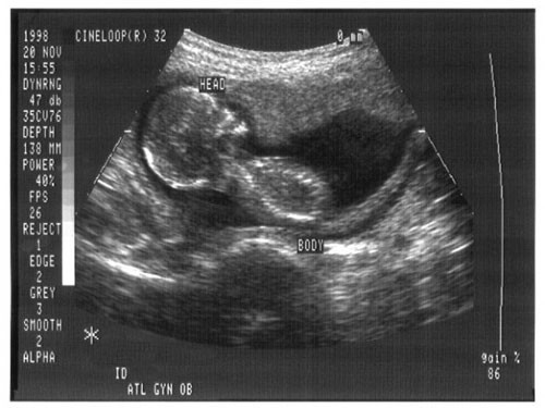 Trẻ trong quá trình bào thai có thể nghe được âm thanh từ bên ngoài tử cung Ảnh: ARSTECHNICA - CDC