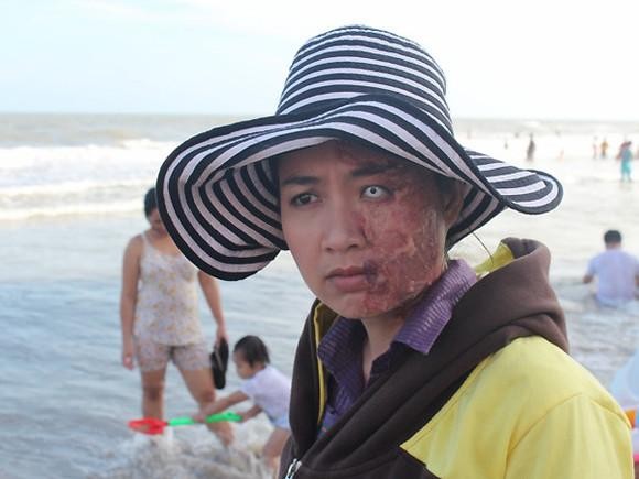 Con mắt bên trái toàn lòng trắng cùng một nửa khuôn mặt bị biến dạng do bị tạt axit của diễn viên Lê Khánh thực sự khiến người xem sợ hãi