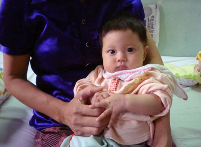 Bé Hoàng Thị Thư, 6 tháng tuổi, ở Lạc Sơn - Hòa Bình, bị bệnh tăng võng máu (LCH) ăn vào gan, lá lách từ khi mới sinh ra. 3 ngày bé phải truyền máu 1 lần để duy trì sự sống. (Ảnh Thu Hòe)