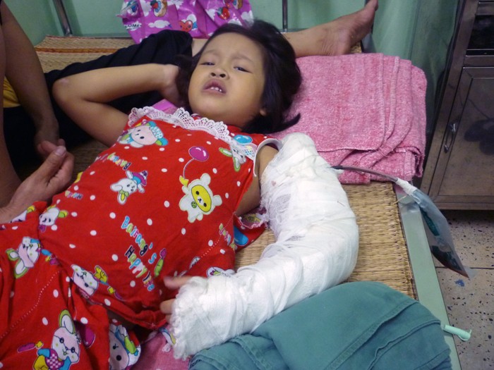 “Con bó bột thế này có được nhận vào lớp học không?”, bé Trần Thu Hường, 6 tuổi, đang điều trị ở Khoa Chỉnh hình nhi. (Ảnh Thu Hòe)