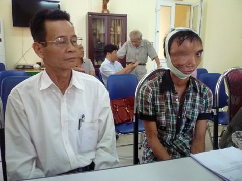 Em Lưu Viết Kiên (Sinh năm 1985, Thanh Trì - Hà Nội) đã được cắt bỏ khối u từng chiếm hai phần khuôn mặt và đang trong quá trình xét nghiệm để chuẩn bị cho ca phẫu thuật mổ mắt có thể phải tiến hành